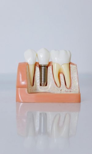 DIENTES